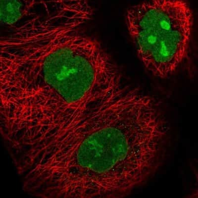 Immunocytochemistry/ Immunofluorescence: UTP18 Antibody [NBP2-13511]