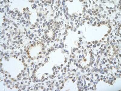 Immunohistochemistry-Paraffin: UTP18 Antibody [NBP3-10541]