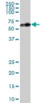 Western Blot: UTP18 Antibody [H00051096-B01P]