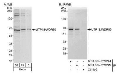 Western Blot: UTP18 Antibody [NB100-77294]