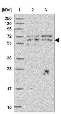 Western Blot: UTP18 Antibody [NBP2-13511]