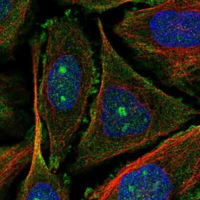 Immunocytochemistry/ Immunofluorescence: UTP20 Antibody [NBP2-58128]