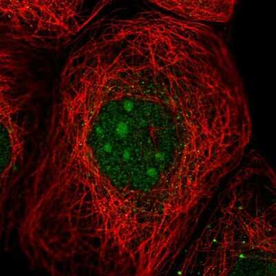 Immunocytochemistry/ Immunofluorescence: UTP23 Antibody [NBP1-92568]