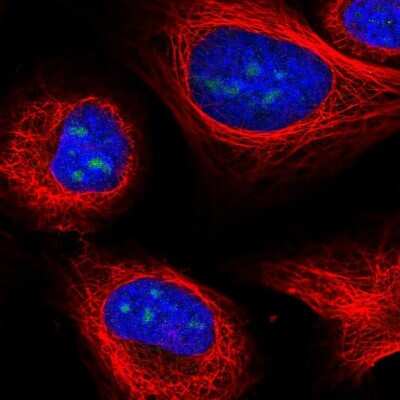 Immunocytochemistry/ Immunofluorescence: UTP3 Antibody [NBP2-58960]
