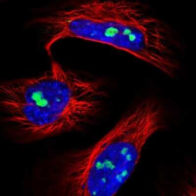 Immunocytochemistry/ Immunofluorescence: UTP6 Antibody [NBP2-55583]