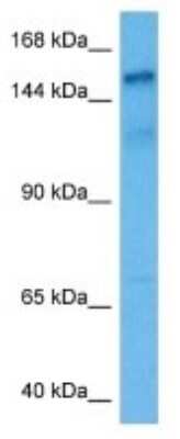 Western Blot: UTY Antibody [NBP3-11015]