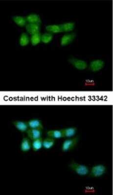 Immunocytochemistry/ Immunofluorescence: UVSSA Antibody [NBP1-32598]