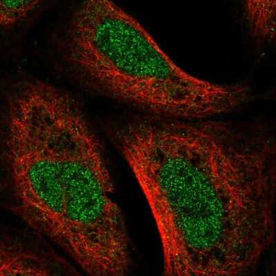 Immunocytochemistry/ Immunofluorescence: UVSSA Antibody [NBP2-55432]