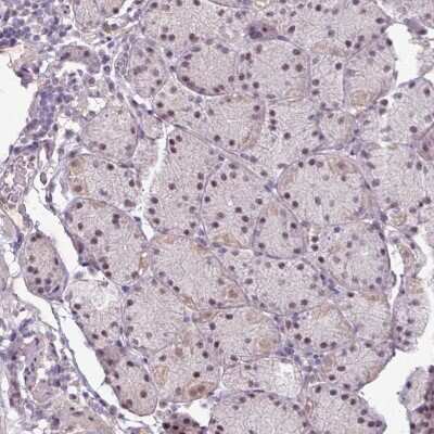 Immunohistochemistry-Paraffin: UVSSA Antibody [NBP2-48981]