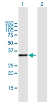 Western Blot: UVSSA Antibody [H00057654-B01P]