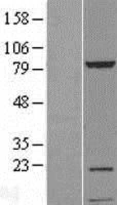 Western Blot: UVSSA Overexpression Lysate [NBL1-12267]
