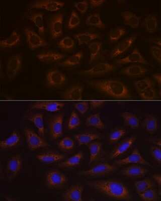 Immunocytochemistry/ Immunofluorescence: UbcH10/UBE2C Antibody (5G5L9) [NBP3-16588]