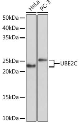 Western Blot: UbcH10/UBE2C Antibody (5G5L9) [NBP3-16588]