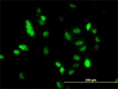 Immunocytochemistry/ Immunofluorescence: UbcH10/UBE2C Antibody (9D3) [H00011065-M01]