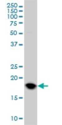 Western Blot: UbcH10/UBE2C Antibody (9D3) [H00011065-M01]