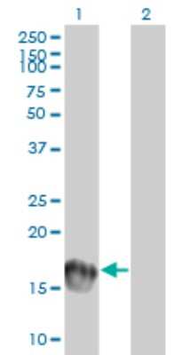 Western Blot: UbcH10/UBE2C Antibody (9D3) [H00011065-M01]