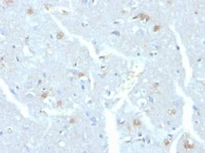 Immunohistochemistry-Paraffin: UbcH10/UBE2C Antibody (CPTC-UBE2C-1) [NBP3-07504]