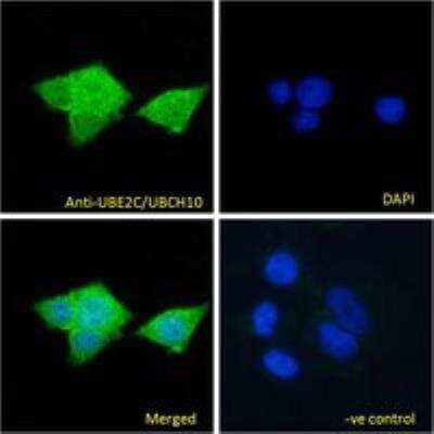 Immunocytochemistry/ Immunofluorescence: UbcH10/UBE2C Antibody [NB100-1084]