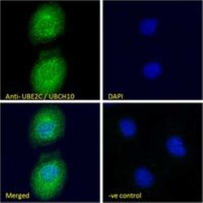 Immunocytochemistry/ Immunofluorescence: UbcH10/UBE2C Antibody [NB100-1084]