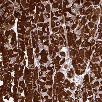 Immunohistochemistry: UbcH10/UBE2C Antibody [NBP2-38745]