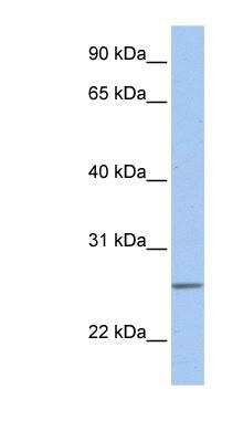 Western Blot: UbcH10/UBE2C Antibody [NBP1-58166]
