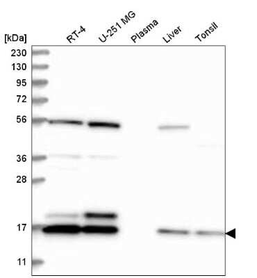 Western Blot: UbcH10/UBE2C Antibody [NBP2-56693]