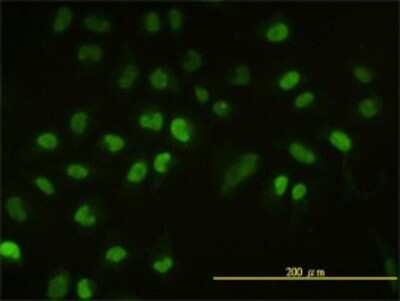 Immunocytochemistry/ Immunofluorescence: UbcH2/UBE2H Antibody (3C4-1A2) [H00007328-M01]