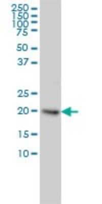 Western Blot: UbcH2/UBE2H Antibody (3C4-1A2) [H00007328-M01]