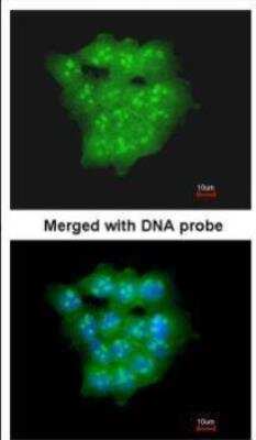 Immunocytochemistry/ Immunofluorescence: UbcH5a/UBE2D1 Antibody [NBP1-32734]