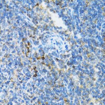 Immunohistochemistry-Paraffin: UbcH5a/UBE2D1 Antibody - BSA Free [NBP2-93678]