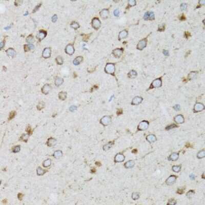 Immunohistochemistry-Paraffin: UbcH5a/UBE2D1 Antibody - BSA Free [NBP2-93678]