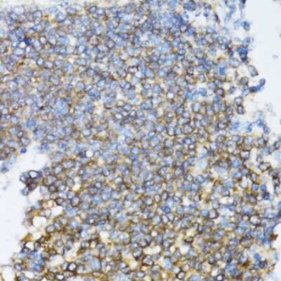 Immunohistochemistry-Paraffin: UbcH5a/UBE2D1 Antibody - BSA Free [NBP2-93678]