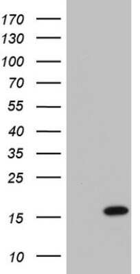 Western Blot: UbcH5a/UBE2D1 Antibody (OTI1E7)Azide and BSA Free [NBP2-74731]