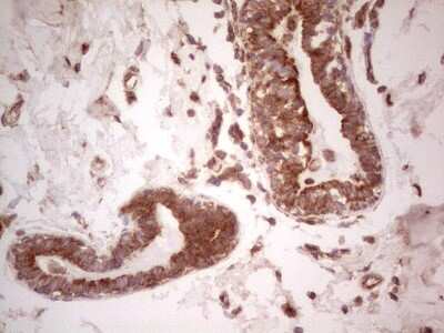 Immunohistochemistry: UbcH5b/UBE2D2 Antibody (OTI2C2) [NBP2-46270]