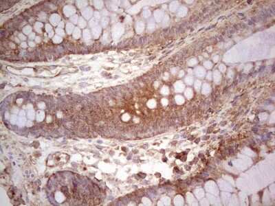 Immunohistochemistry: UbcH5b/UBE2D2 Antibody (OTI2C2) [NBP2-46270]