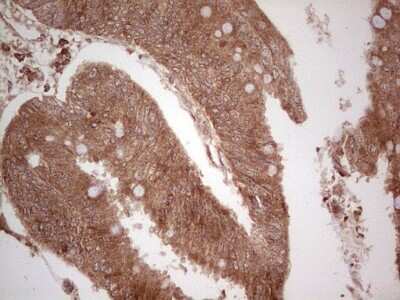 Immunohistochemistry: UbcH5b/UBE2D2 Antibody (OTI2C2) [NBP2-46270]