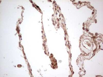 Immunohistochemistry: UbcH5b/UBE2D2 Antibody (OTI2C2) [NBP2-46270]