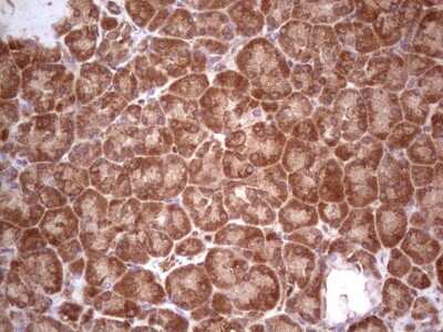 Immunohistochemistry: UbcH5b/UBE2D2 Antibody (OTI2C2) [NBP2-46270]