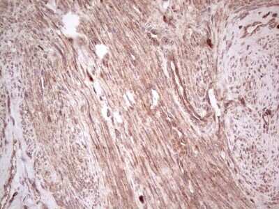 Immunohistochemistry: UbcH5b/UBE2D2 Antibody (OTI2C2) [NBP2-46270]