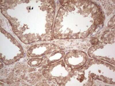 Immunohistochemistry: UbcH5b/UBE2D2 Antibody (OTI2C2) [NBP2-46270]