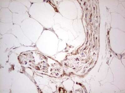 Immunohistochemistry: UbcH5b/UBE2D2 Antibody (OTI2C2) [NBP2-46270]