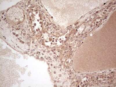 Immunohistochemistry: UbcH5b/UBE2D2 Antibody (OTI2C2) [NBP2-46270]