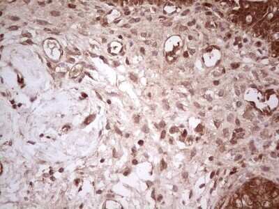 Immunohistochemistry: UbcH5b/UBE2D2 Antibody (OTI2C2) - Azide and BSA Free [NBP2-74732]