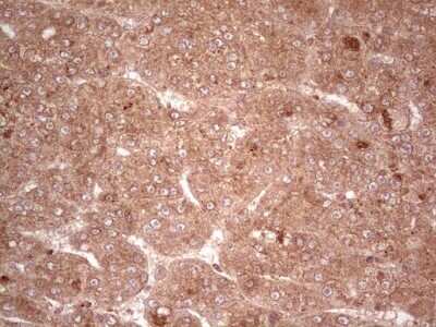 Immunohistochemistry: UbcH5b/UBE2D2 Antibody (OTI2C2) - Azide and BSA Free [NBP2-74732]