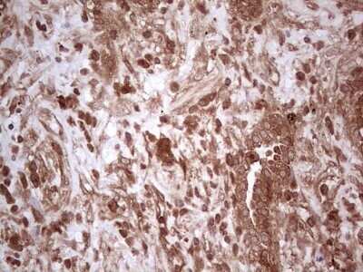 Immunohistochemistry: UbcH5b/UBE2D2 Antibody (OTI2C2) - Azide and BSA Free [NBP2-74732]