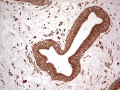Immunohistochemistry: UbcH5b/UBE2D2 Antibody (OTI2C2) - Azide and BSA Free [NBP2-74732]