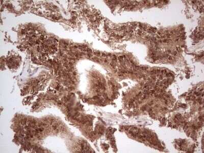 Immunohistochemistry: UbcH5b/UBE2D2 Antibody (OTI2C2) - Azide and BSA Free [NBP2-74732]