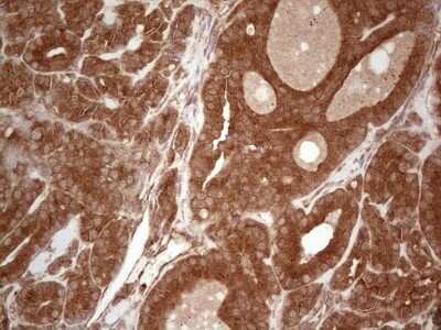 Immunohistochemistry: UbcH5b/UBE2D2 Antibody (OTI2C2) - Azide and BSA Free [NBP2-74732]