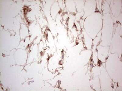 Immunohistochemistry: UbcH5b/UBE2D2 Antibody (OTI2C2) - Azide and BSA Free [NBP2-74732]