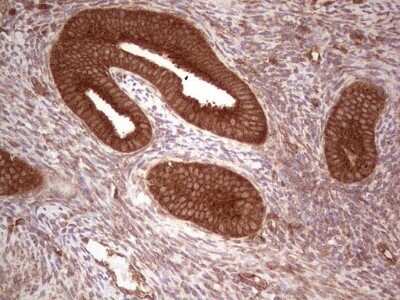 Immunohistochemistry: UbcH5b/UBE2D2 Antibody (OTI2C2) - Azide and BSA Free [NBP2-74732]